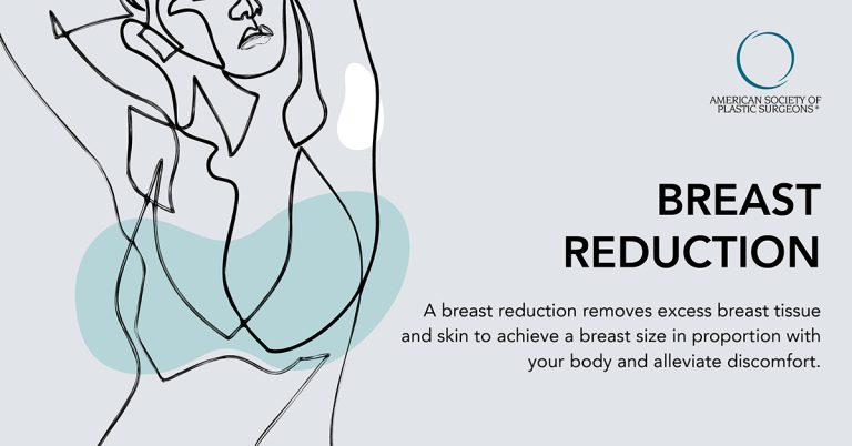 reduction mammoplasty in Iran
